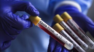 Kongo Demokratik Cumhuriyeti’ndeki Ebola salgınında can kaybı sayısı 1405’e yükseldi